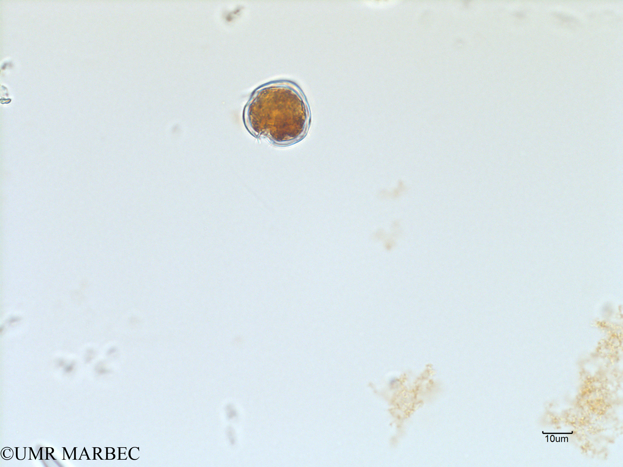 phyto/Scattered_Islands/iles_glorieuses/SIREME November 2015/Protoperidinium spp ( A VERIFIER-SIREME-Glorieuses2015-ech4-231116-photo3)(copy).jpg